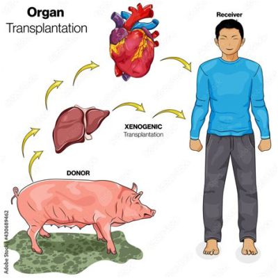  Xenotransplantation Potential: Décryptage des Propriétés Exceptionnelles du Xénogreffe!