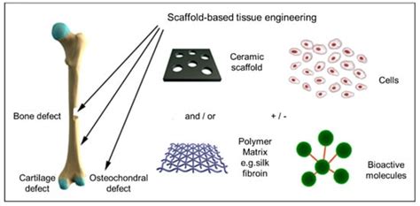  Polyethylene:  Biocompatible Marvel for Orthopedic Implants and Tissue Engineering Applications!